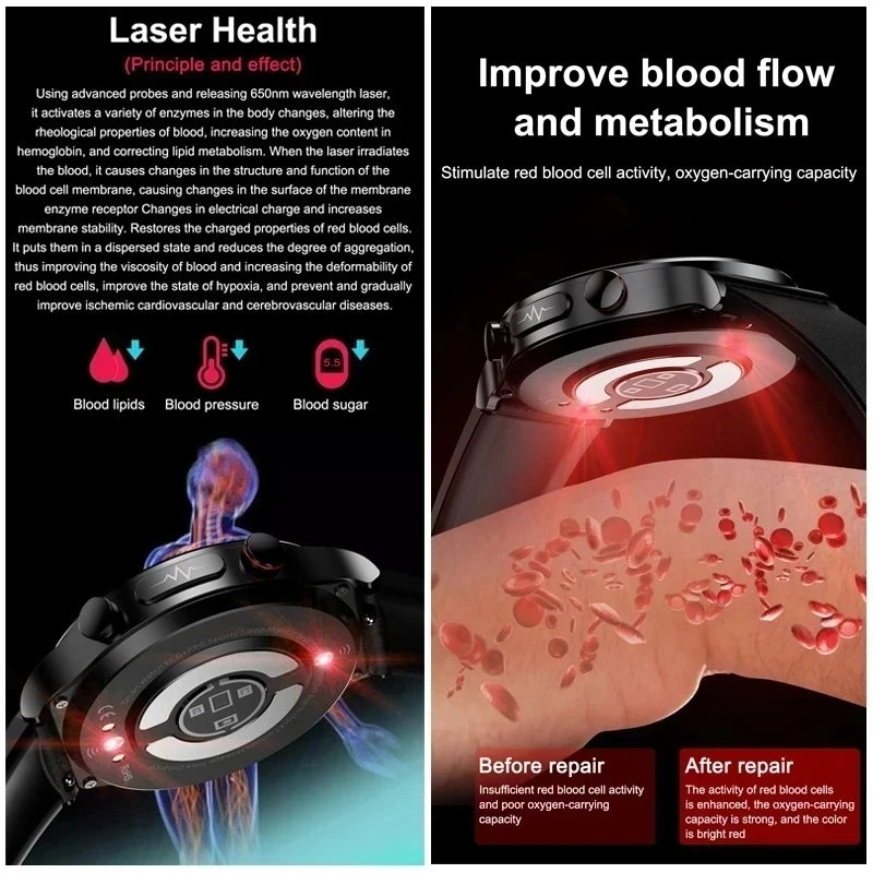 2024 New Non-invasive Blood glucose Smart Watch Blood pressure Blood lipids Uric acid AMOLED HD Screen Laser therapy Smartwatch